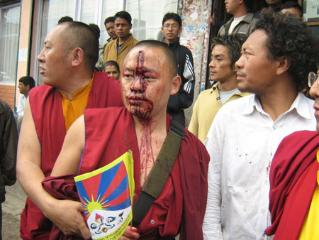 “Di fronte alle proteste pacifiche dei tibetani, le autorità cinesi ricorrono in modo abituale ad arresti arbitrati, carcerazioni e torture"